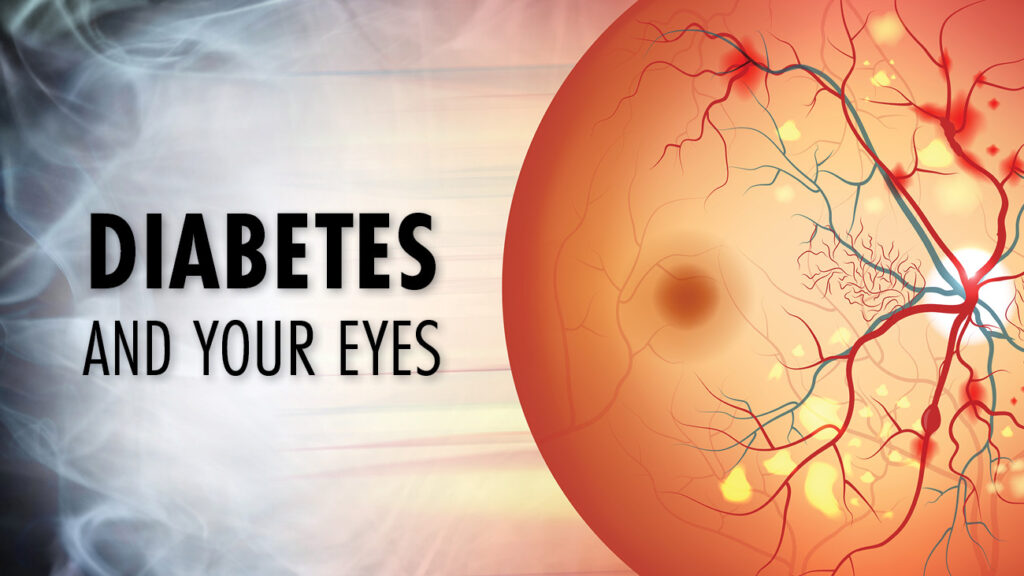 Diabetes and Your Eyes